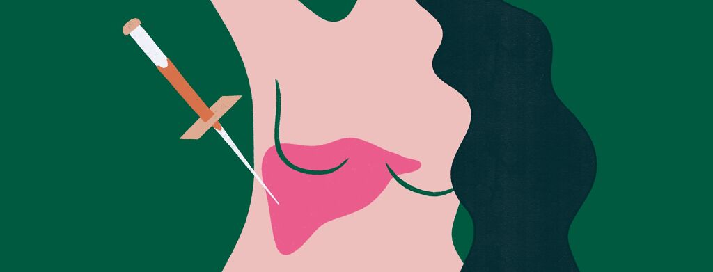 My Liver Biopsy Experience image